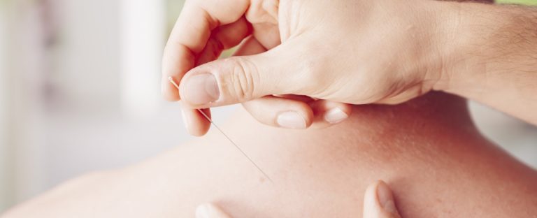 hmo vs ppo for acupuncture practices