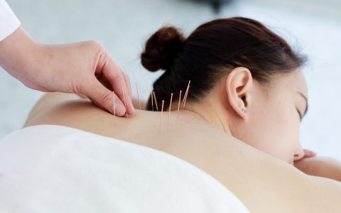 billing for acupncture