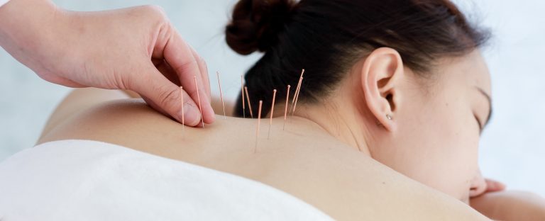 billing for acupncture