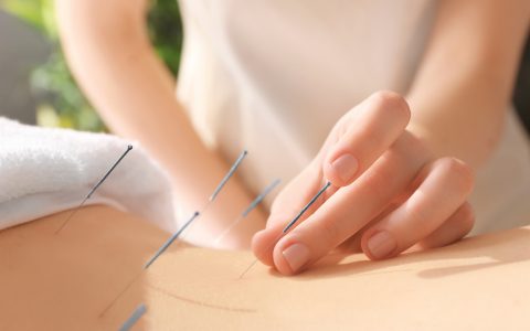 acupuncture treatments