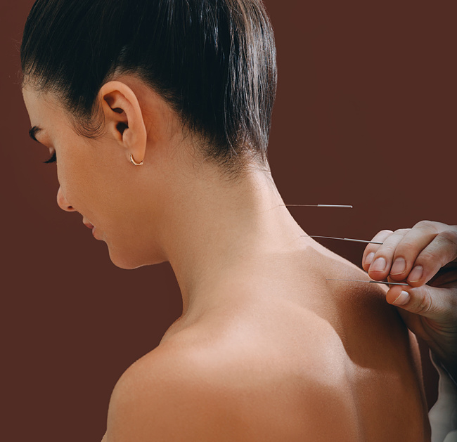 acupuncture billing treatments