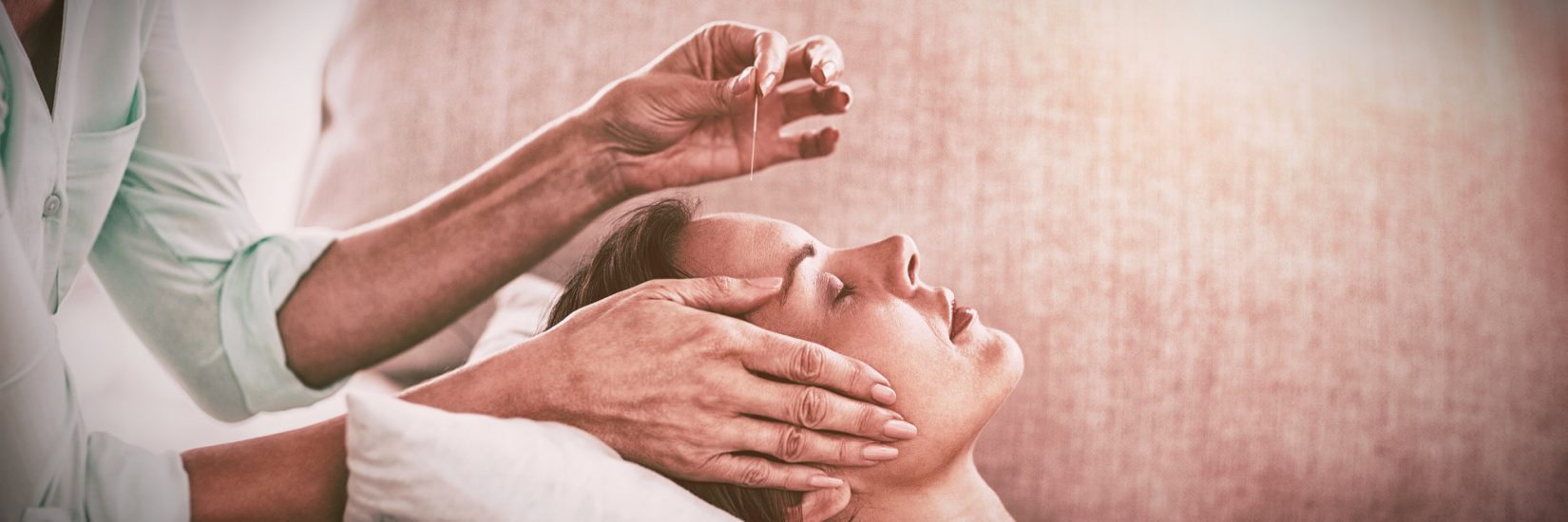 Woman receiving acupuncture treatment due to Acupuncture Billing Services