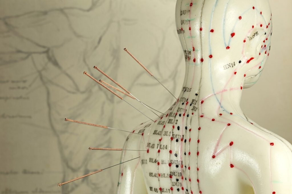 holistic patient care - Acupuncture CPT Codes for 2023