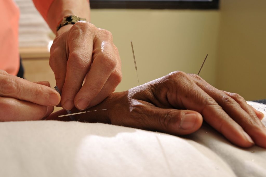 new medicare bill would expand acupuncture coverage