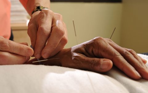 new medicare bill would expand acupuncture coverage