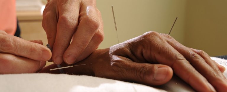 new medicare bill would expand acupuncture coverage