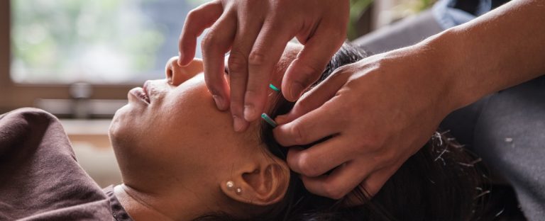 Check out these marketing tips for your acupuncture practice